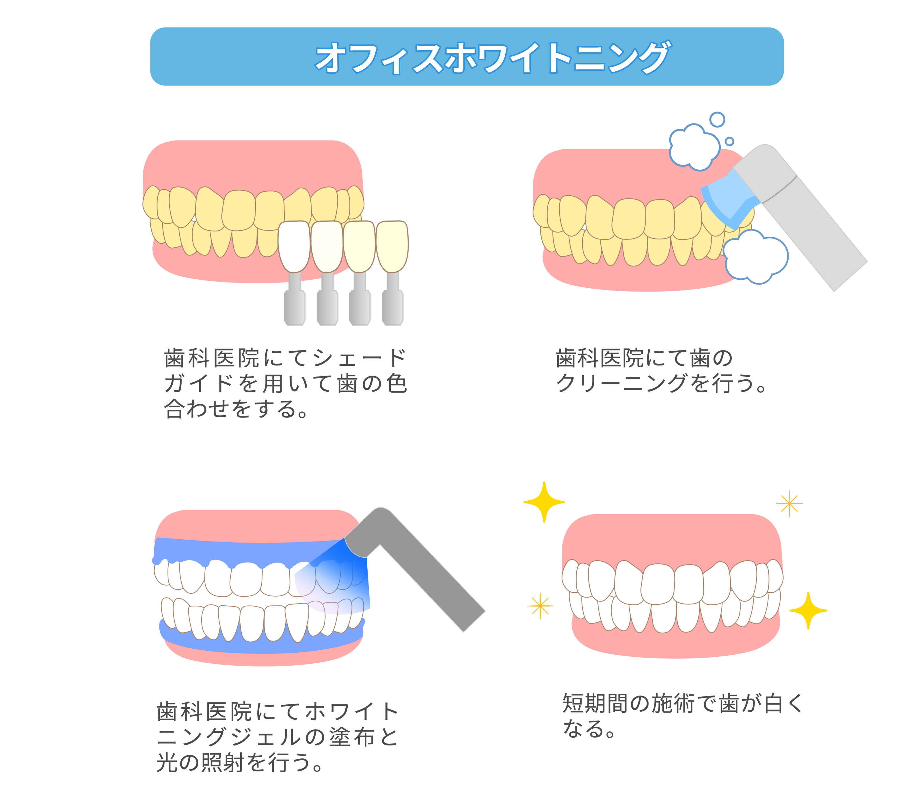 ofice-whitening